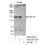 28432. RABBIT ANTI-CEP135 ANTIBODY AFFINITY PURIFIED 100UL BETHYL LABS