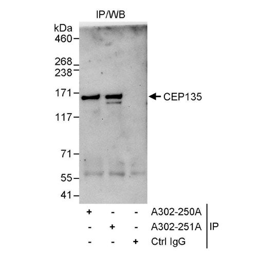 28432. RABBIT ANTI-CEP135 ANTIBODY AFFINITY PURIFIED 100UL BETHYL LABS