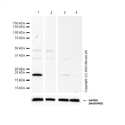 29187 Anti P21 Antibody Epr3993 100ul Abcam Ctr Scientific 4853