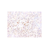 28769. ANTI-HIF-1 ALPHA ANTIBODY 100UL ABCAM