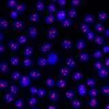 28000. ANTI-NUCLEOLIN ANTIBODY (364-5) 100UG ABCAM