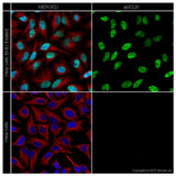 28779. GOAT ANTI-RAT IGG H&L (ALEXA FLUOR 488) PREADSORBED 500UG ABCAM