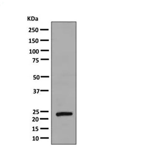 23869. RECOMBINANT ANTI-GROWTH HORMONE ANTIBODY (EPR11047(B) 100UL ABCAM
