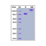 28023. RECOMBINANT HUMAN GROWTH HORMONE RECEPTOR PROTEIN (FC CHIMERA ACTIVE) 50UG ABCAM