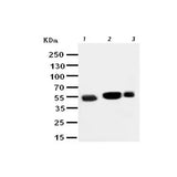 29463. ANTI-EAAT3 ANTIBODY- N-TERMINAL 100UG ABCAM