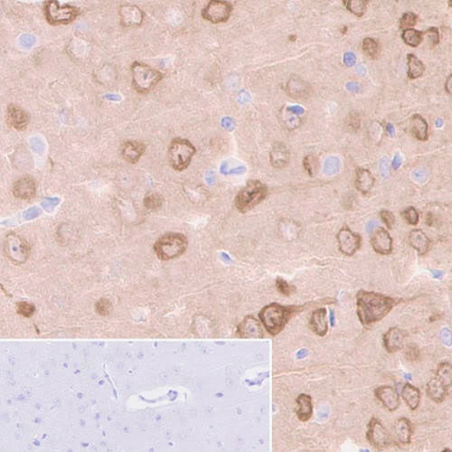 29474. RECOMBINANT ANTI-NEUROGRANIN ANTIBODY (EPR21152) 100UL ABCAM