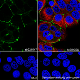 28038. RECOMBINANT ANTI-ZO1 TIGHT JUNCTION PROTEIN ANTIBODY (EPR19945-296) 100UL ABCAM