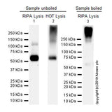 29480. RECOMBINANT ANTI-VGLUT1 ANTIBODY (EPR22269) 100UL ABCAM