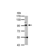 23879. ANTI-GOLGIN 97 ANTIBODY - C-TERMINAL 100UL ABCAM