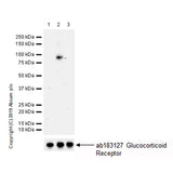 29481. RECOMBINANT ANTI-GLUCOCORTICOID RECEPTOR (PHOSPHO S226) ANTIBODY (EPR22216-414) 100UL ABCAM