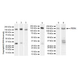 27924. RECOMBINANT ANTI-PERK ANTIBODY (EPR19876-294) 100UL ABCAM