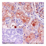55761. RECOMBINANT ANTI-KLOTHO ANTIBODY (EPR6856)-BSA AND AZIDE FREE 100UG ABCAM