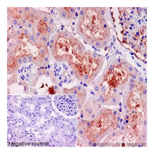 55761. RECOMBINANT ANTI-KLOTHO ANTIBODY (EPR6856)-BSA AND AZIDE FREE 100UG ABCAM