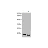 29851. ANTI-CRABP1 ANTIBODY 100UG ABCAM