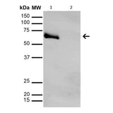 28796. ANTI-METHYLGLYOXAL ANTIBODY (9F11) 100UG ABCAM