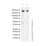 29487. RECOMBINANT ANTI-CASPR ANTIBODY (K65/35) 100UG ABCAM