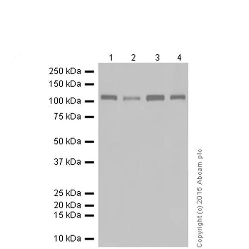 23884. ANTI-MYOSIN PHOSPHATASE + MYOSIN PHOSPHATASE 2 ANTIBODY (YE336) 100UL ABCAM