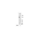 27959. ANTI-AC5 ANTIBODY 100UG ABCAM