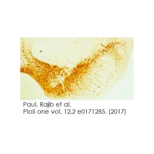 27964. NORMAL DONKEY SERUM 25ML ABCAM CTR Scientific