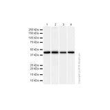 29530. RECOMBINANT ANTI-ACADM/MCAD ANTIBODY (EPR3708) 100UL ABCAM