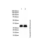 29866. RECOMBINANT ANTI-SCP3 ANTIBODY (COR 10G11/7) 100UG ABCAM
