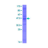 55953. RECOMBINANT HUMAN CMTM6 GST (N-TERM) PROTEIN 25UG NOVUS BIOLOGICALS