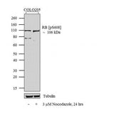 51198. ANTI-RETINOBLASTOMA (PHOSPHO- SERINE608) - THERMO SCIENTIFIC
