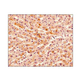 29991. OSTEOPROTEGERIN/TNFRSF11B ANTIBODY (98A1071) 0.1MG NOVUS BIOLOGICALS