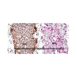 28194. SURVIVIN ANTIBODY-BSA FREE 0.025ML NOVUS BIOLOGICALS