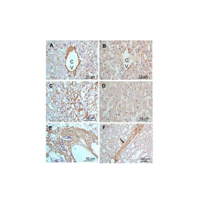 29986. COLLAGEN III ALPHA 1/COL3A1 ANTIBODY 0.02MG NOVUS BIOLOGICALS