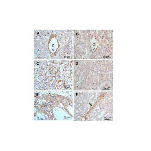 29986. COLLAGEN III ALPHA 1/COL3A1 ANTIBODY 0.02MG NOVUS BIOLOGICALS