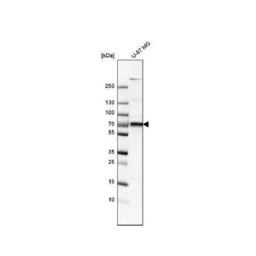 28823. 5'-NUCLEOTIDASE/CD73 ANTIBODY 0.1ML NOVUS BIOLOGICALS
