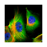 28193. S100A6 ANTIBODY 0.1ML NOVUS BIOLOGICALS