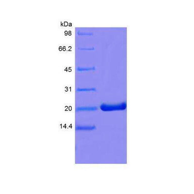 55472. RECOMBINANT MOUSE PROLACTIN PROTEIN 1MG NOVUS BIOLOGICALS