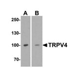 29004. TRPV4 ANTIBODY 0.1MG NOVUS BIOLOGICALS