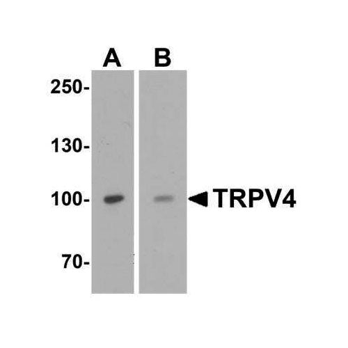 29004. TRPV4 ANTIBODY 0.1MG NOVUS BIOLOGICALS