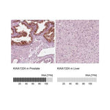 29548. ANTIBODY POLYCLONAL RABBIT EIG121 100UL NOVUS BIOLOGICALS