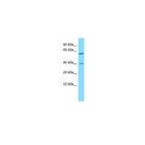 28195. SYT10 ANTIBODY 0.1ML NOVUS BIOLOGICALS