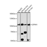 51171. ZFPM1 ANTIBODY 0.1ML - NOVUS BIOLOGICALS
