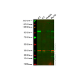 27997. RECOMBINANT ANTI-GAB1 ANTIBODY (EPR375) 100UL ABCAM