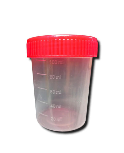 51548. VASO RECOLECTOR 100ML NO ESTERIL C/TAPA ROJA C/80 PIEZAS - PLASTIC WORLD