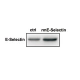 7513. RECOMBINANT MOUSE E-SELECTIN/CD62E FC CHIMERA PROTEIN CF 100UG - R&D SYSTEMS