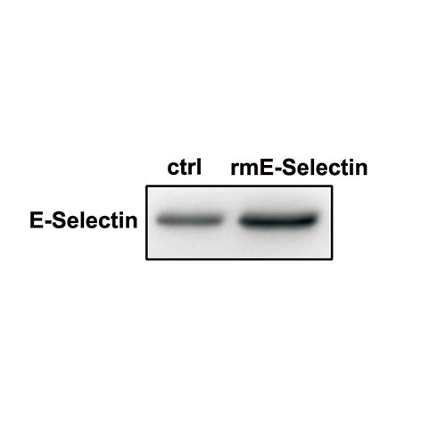 7513. RECOMBINANT MOUSE E-SELECTIN/CD62E FC CHIMERA PROTEIN CF 100UG - R&D SYSTEMS