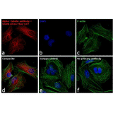 22462. GOAT ANTI-RABBIT IGG (H+L) CROSS-ADSORBED SECONDARY ANTIBODY ALEXA FLUOR 647 1MG INVITROGEN