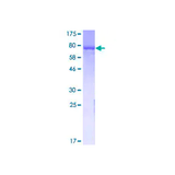 56868. RECOMBINANT HUMAN GAD65 PROTEIN 10UG ABCAM