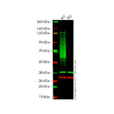 22762. RECOMBINANT ANTI-GLUCOSE TRANSPORTER GLUT1 ANTIBODY (EPR3915) 100UL ABCAM
