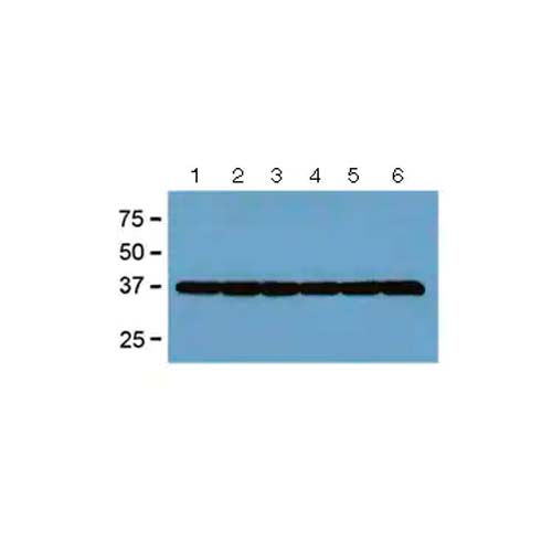 20582. ANTI- GAPDH ANTIBODY (GA1R) LOADING CONTROL 100UG - ABCAM
