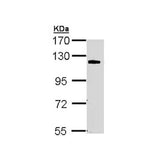 22770. ANTI-CARMA 3 ANTIBODY 100UL ABCAM