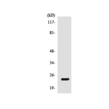 26474. ANTI-SCN2B ANTIBODY 100UG ABCAM