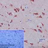 26423. RECOMBINANT ANTI-GLUTAMINASE ANTIBODY (EP7212) 100UL ABCAM